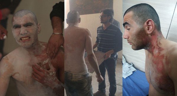 خودسوزی و رنج در پرفورمنس کابوس‌مان پابرجاست